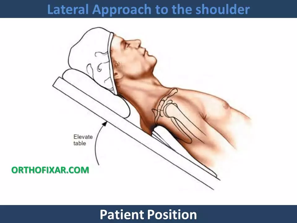 Lateral Approach to the shoulder