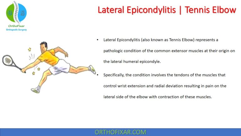 Lateral Epicondylitis