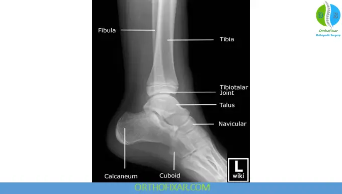 Lateral View of the Ankle