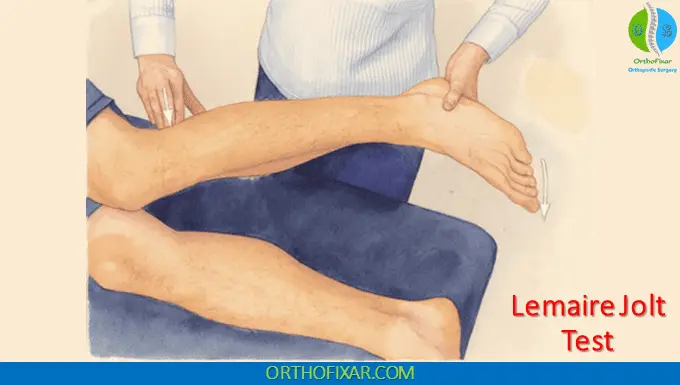 Lemaire Jolt Test For ACL Tears 1 Lemaire Jolt Test For ACL Tears