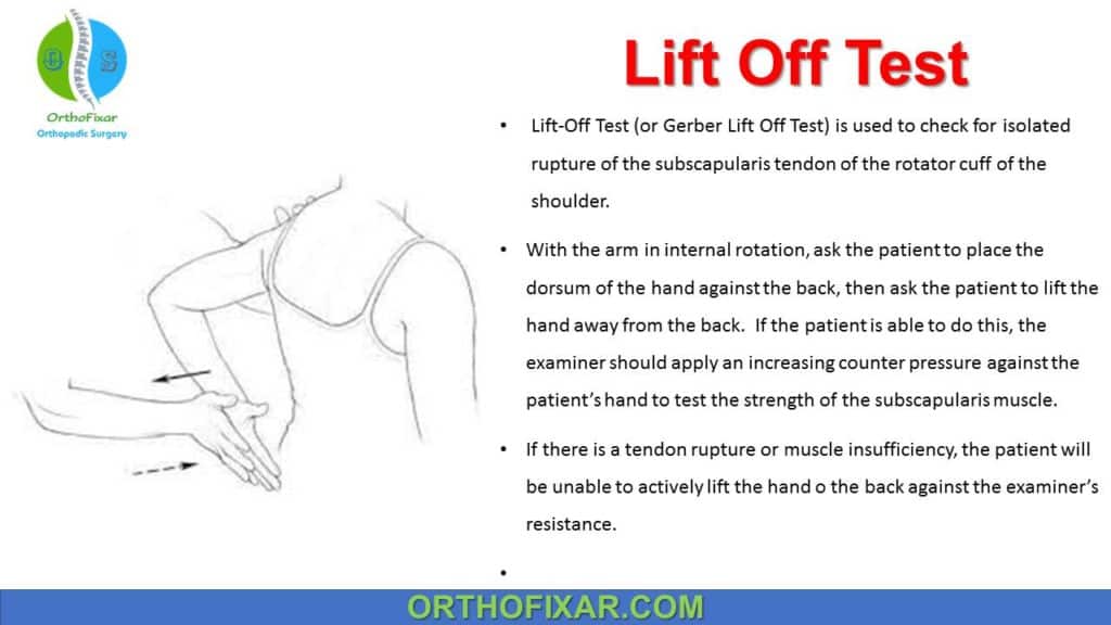 Sulcus Sign | Inferior Drawer Test | OrthoFixar 2025