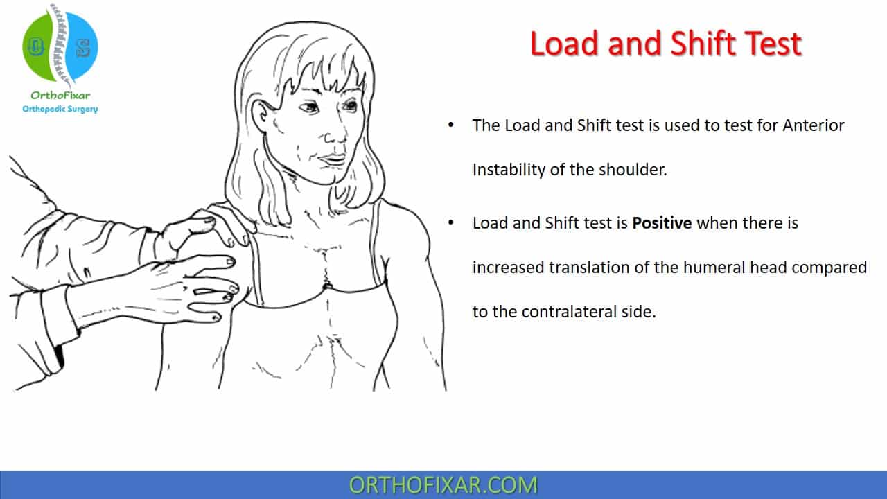 Load And Shift Test Anterior Instability Of The Shoulder