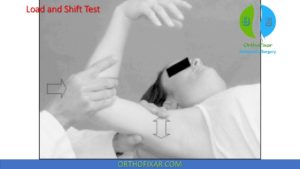 Load And Shift Test: Anterior Instability Of The Shoulder
