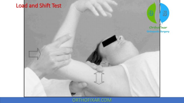 Load And Shift Test Anterior Instability Of The Shoulder