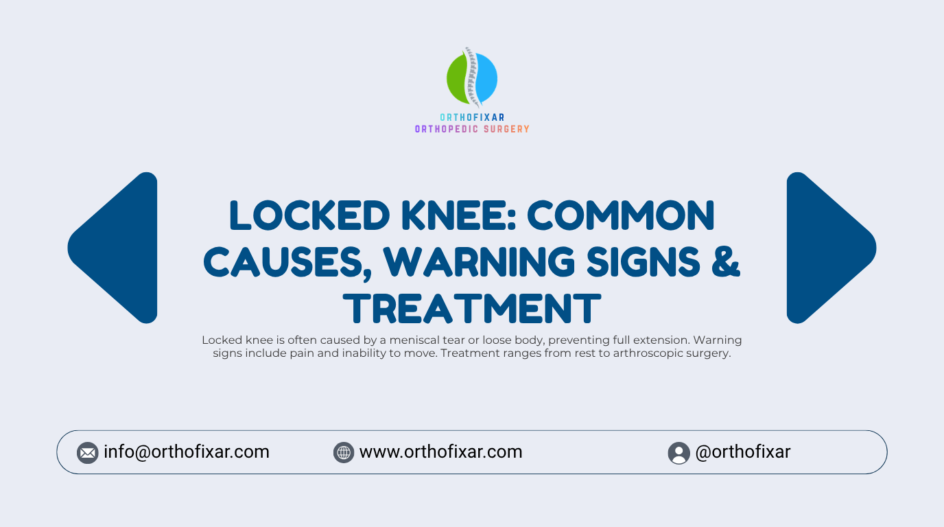 Locked Knee Common Causes Warning Signs Treatment