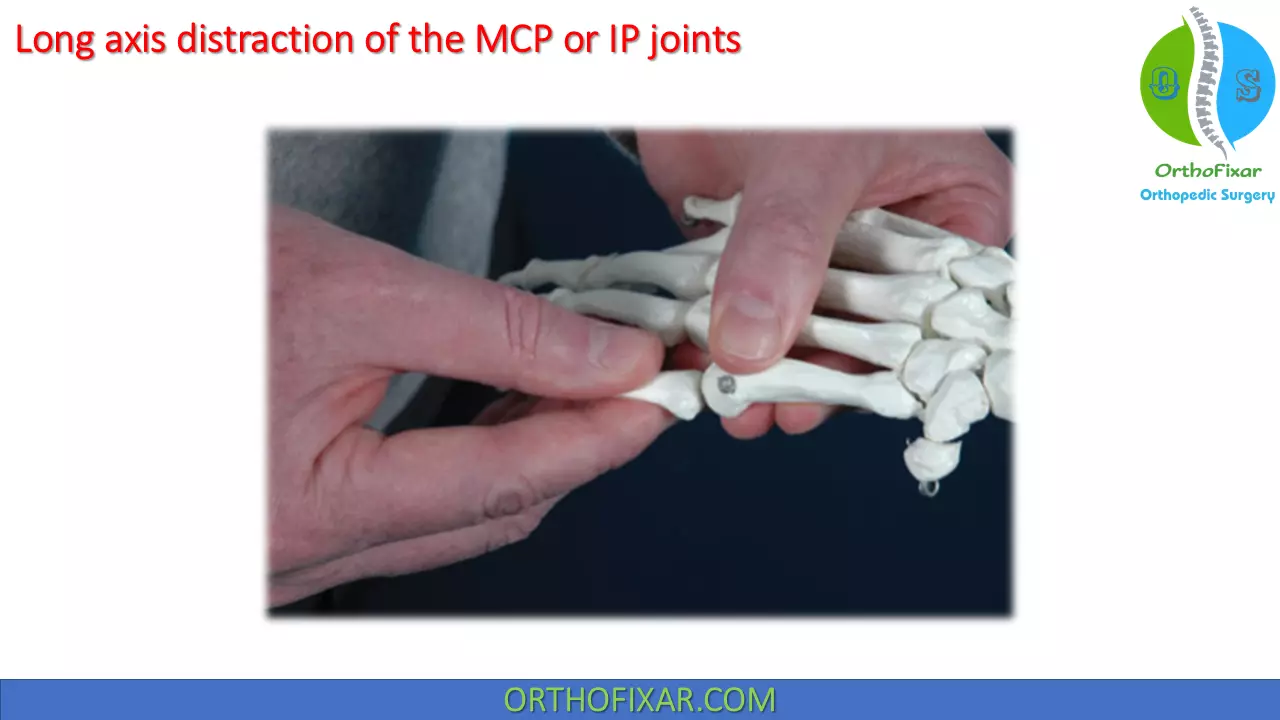 Long axis distraction of the MCP or IP joints