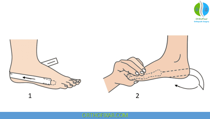 Low Dye Taping 1 Low Dye Taping 1