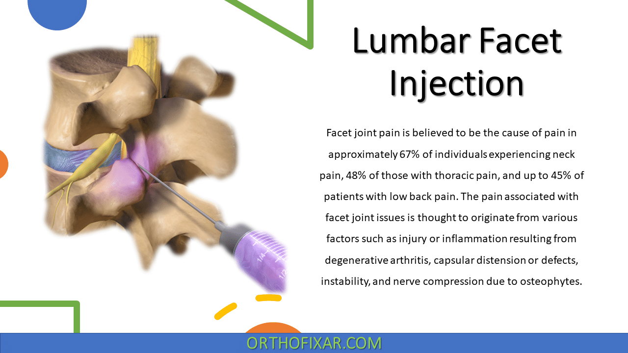  Lumbar Facet Injection 