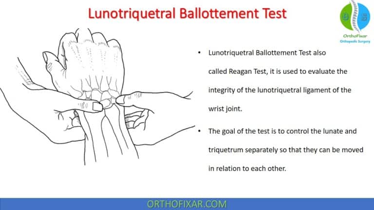 Lunotriquetral Ballottement Test