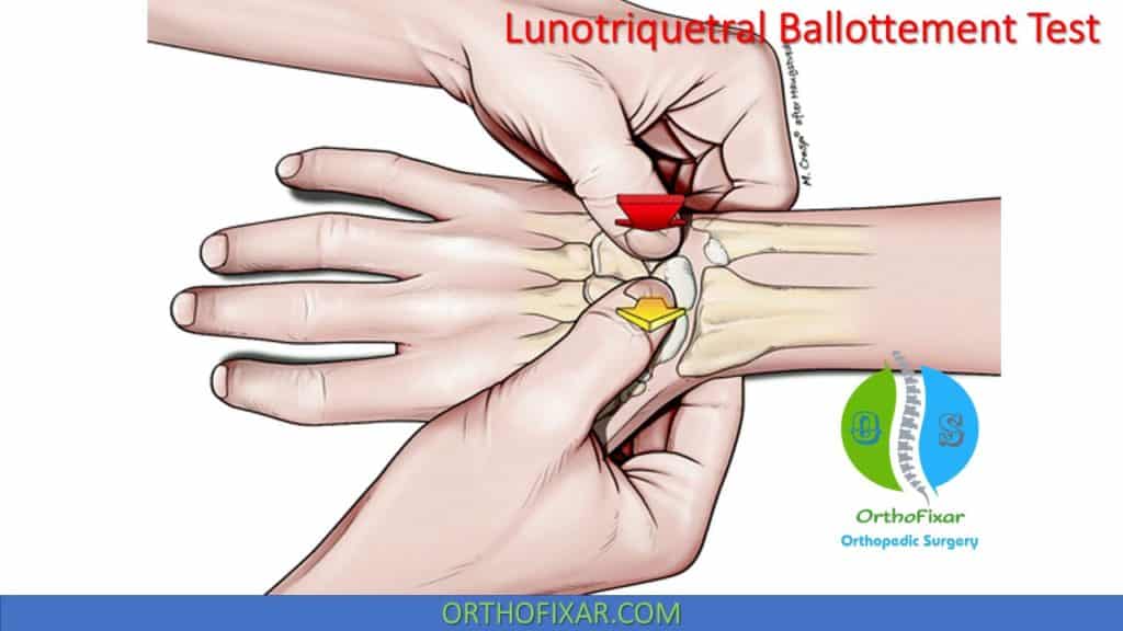 lunotriquetral-ballottement-test-easy-explained-orthofixar