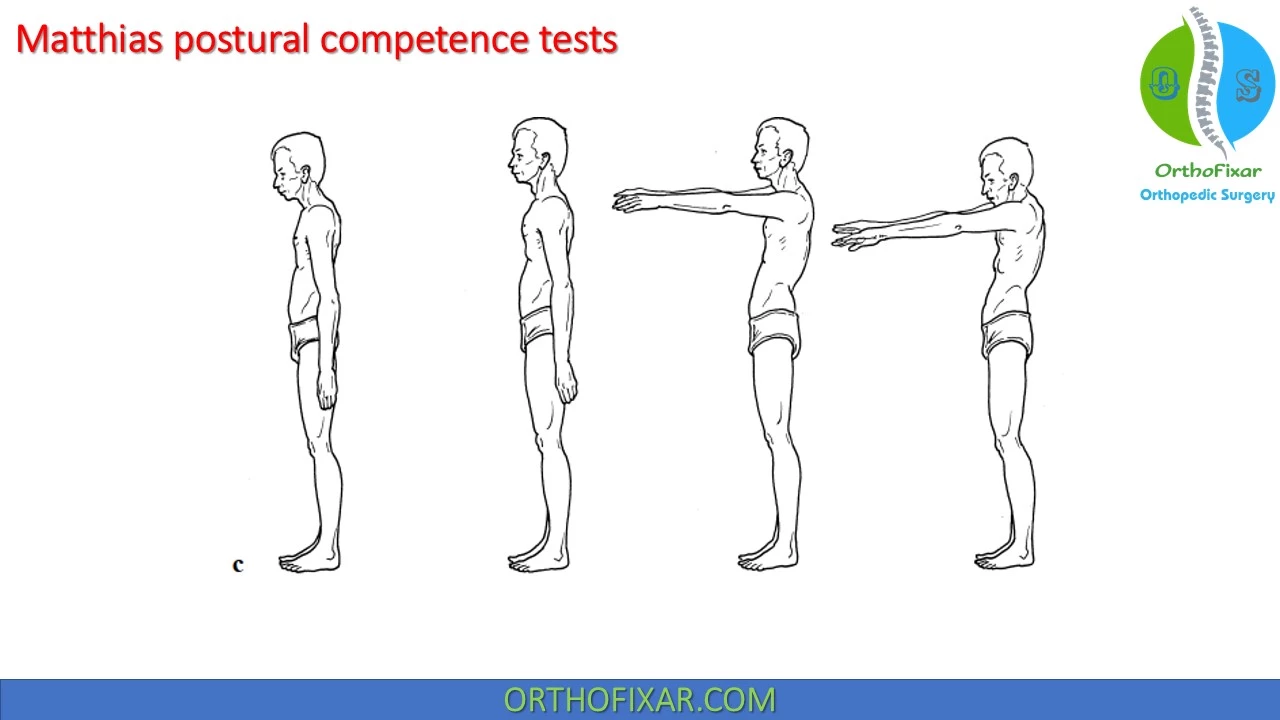 Matthias Postural Competence Tests - Postural deterioration