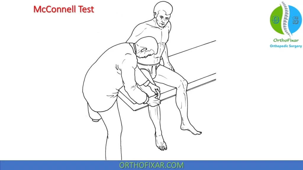 McConnell Patellofemoral knee Test