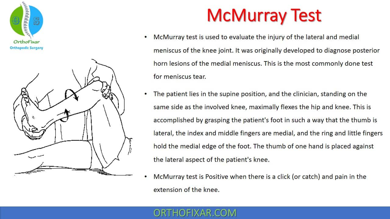  McMurray Test for Meniscus Injury 