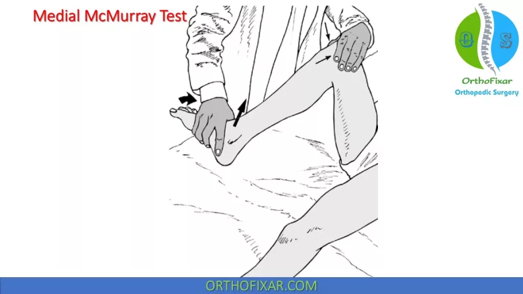 Medial McMurray Test