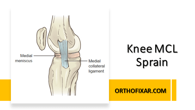 Medial Collateral Ligament Injuries