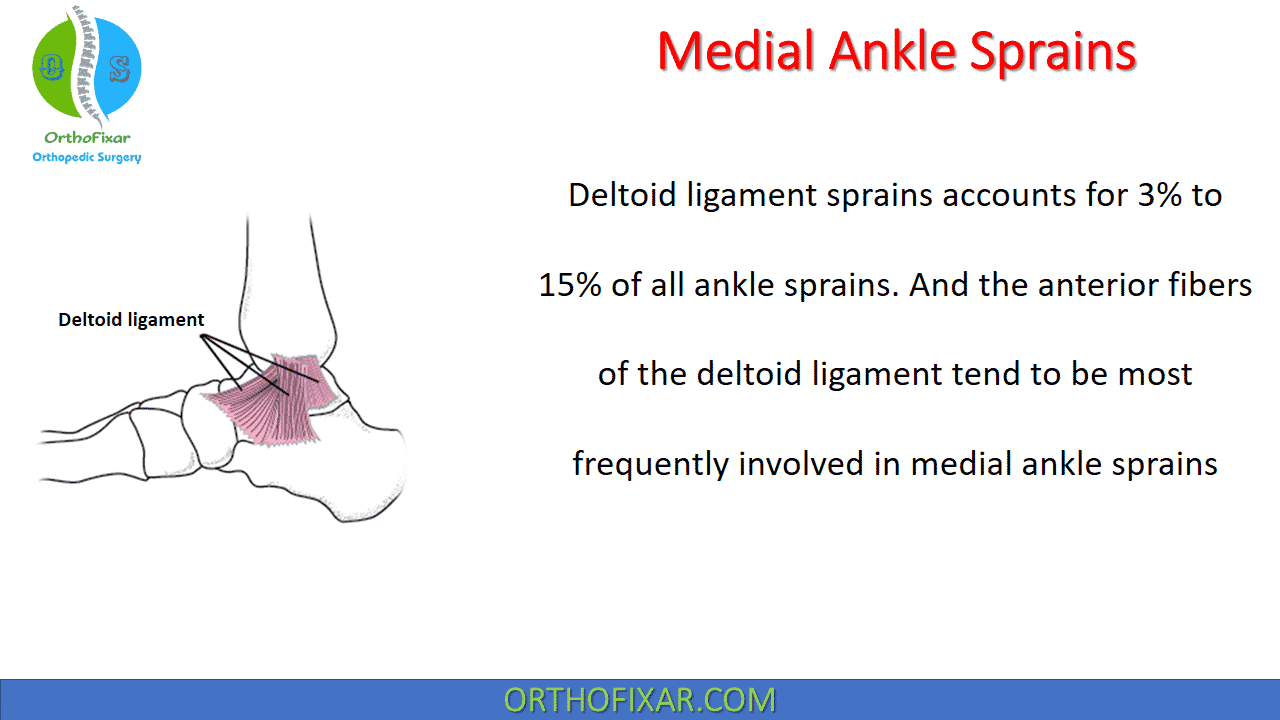 medial ankle sprain