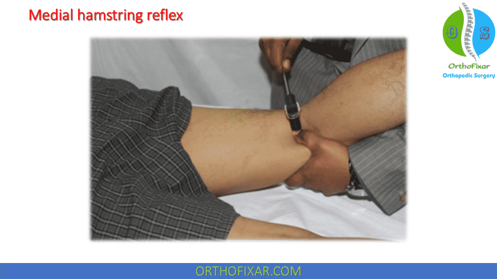 Medial hamstring reflex -L5 nerve root