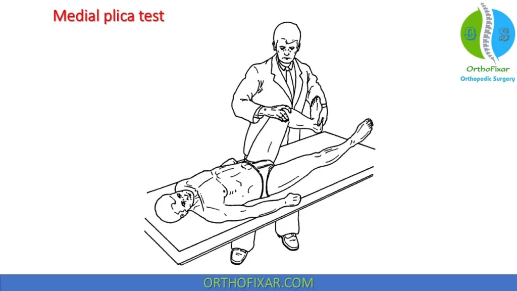 Medial plica syndrome test