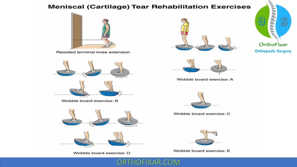 Meniscus Tear Rehabilitation Exercises