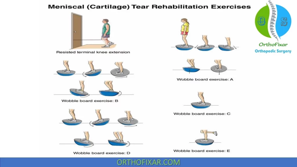 Knee Meniscus Tear Causes Symptoms Treatment Rehabilitation