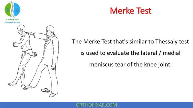 Merke test