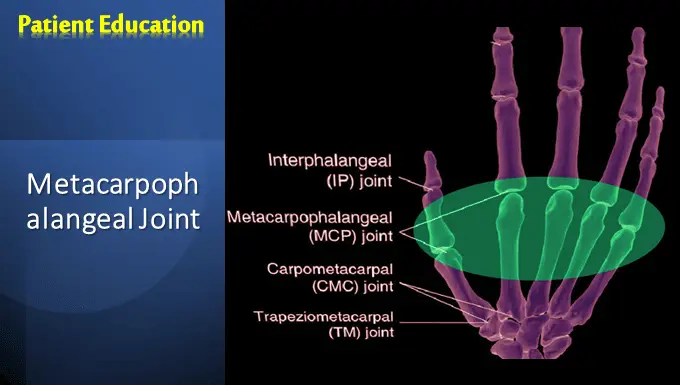 Metacarpophalangeal Joint