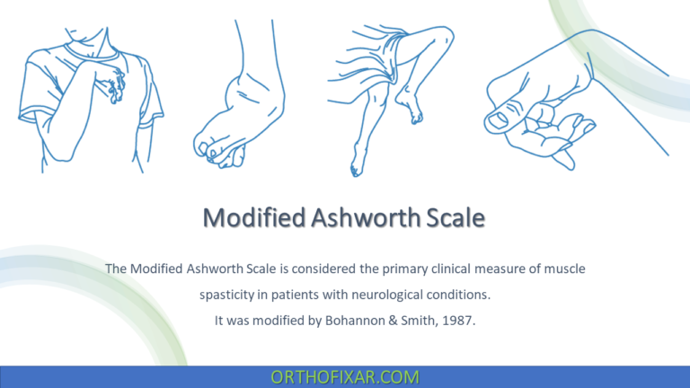 Modified Ashworth Scale
