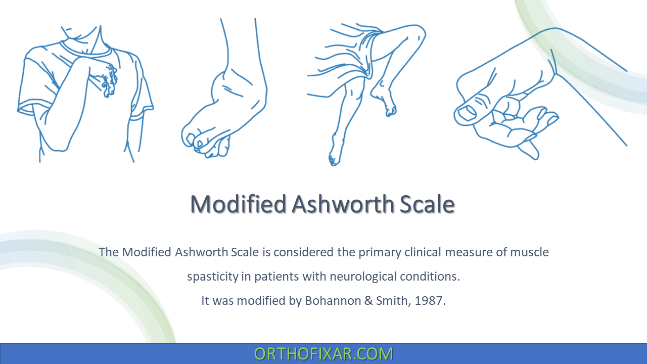 Modified Ashworth Scale 