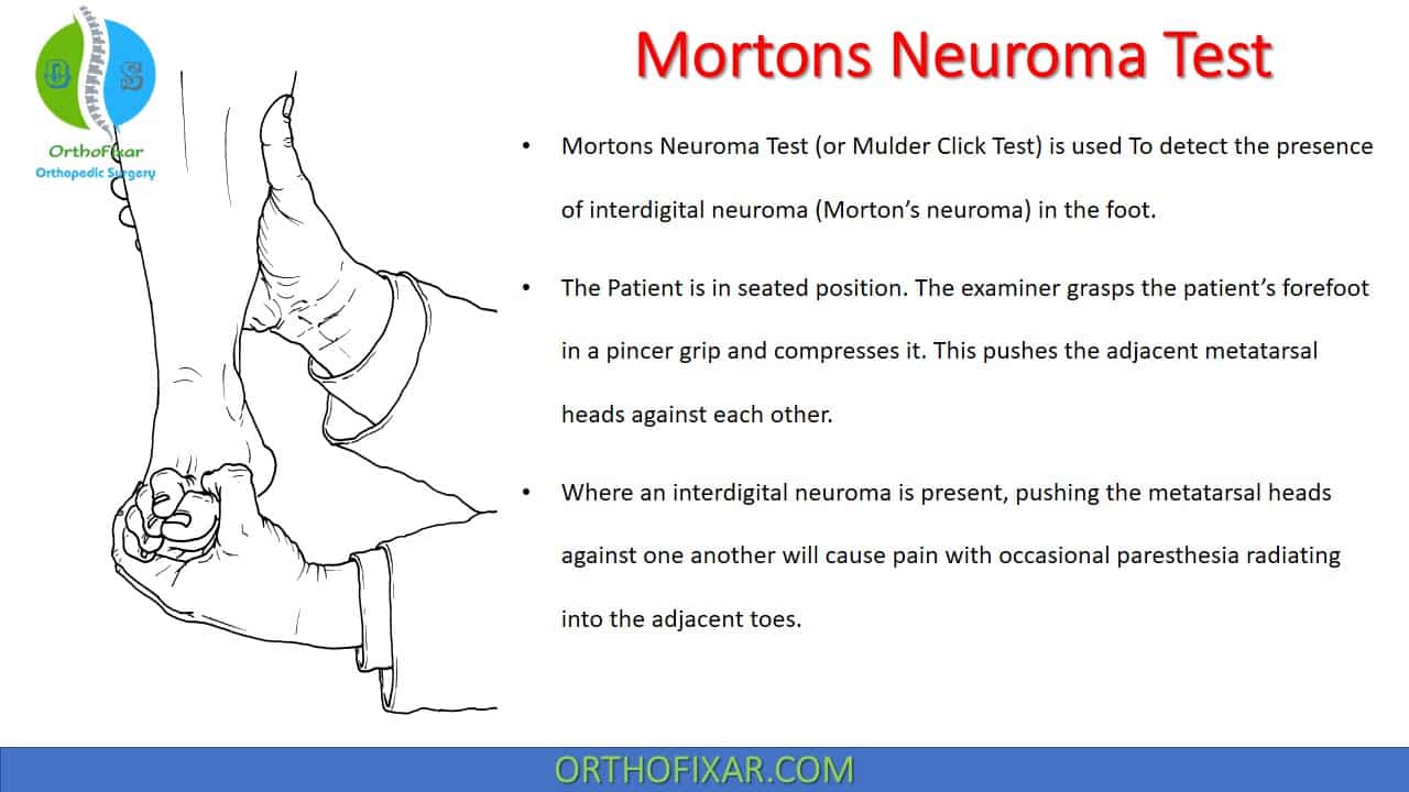  Mortons Neuroma Test 