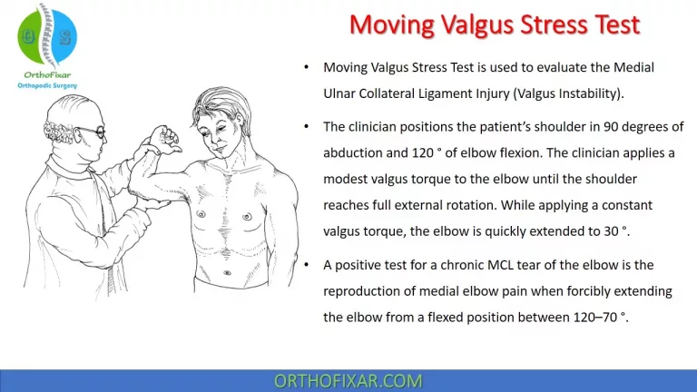 Moving Valgus Stress Test