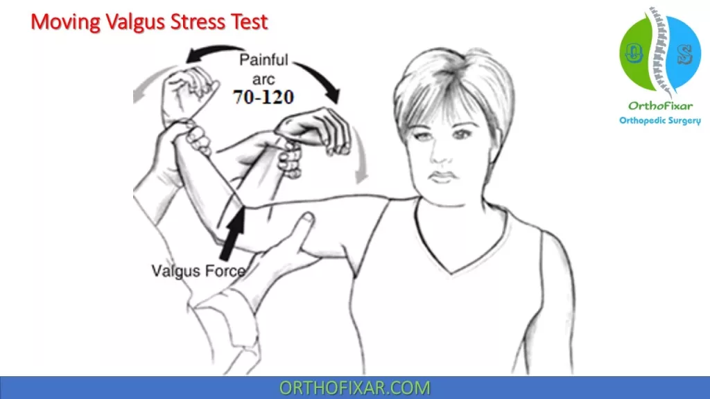 Moving Valgus Stress Test