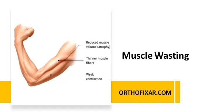 Muscle Wasting