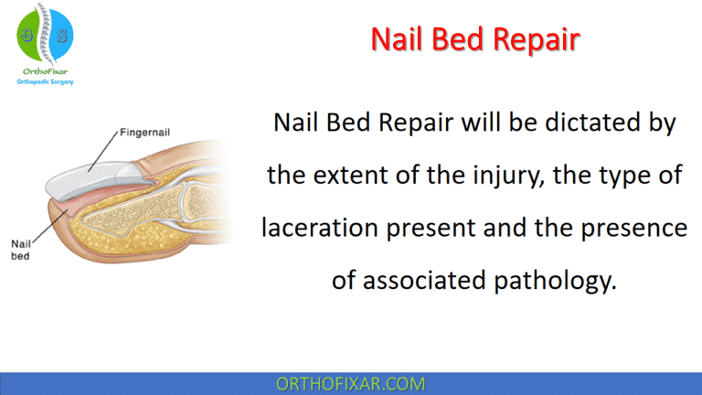 Nail Bed Repair