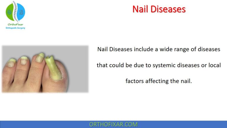 Nail Diseases
