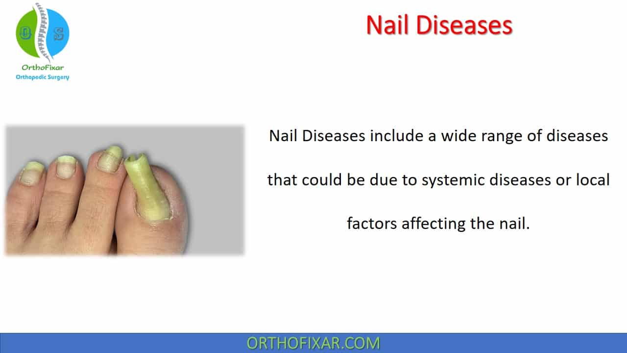Nail Diseases | OrthoFixar