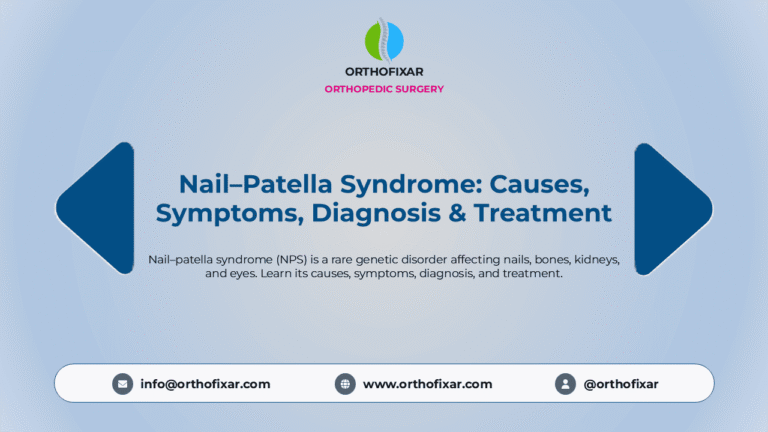 Nail-Patella Syndrome