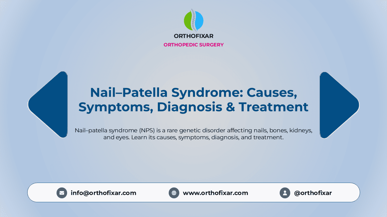Nail-Patella Syndrome
