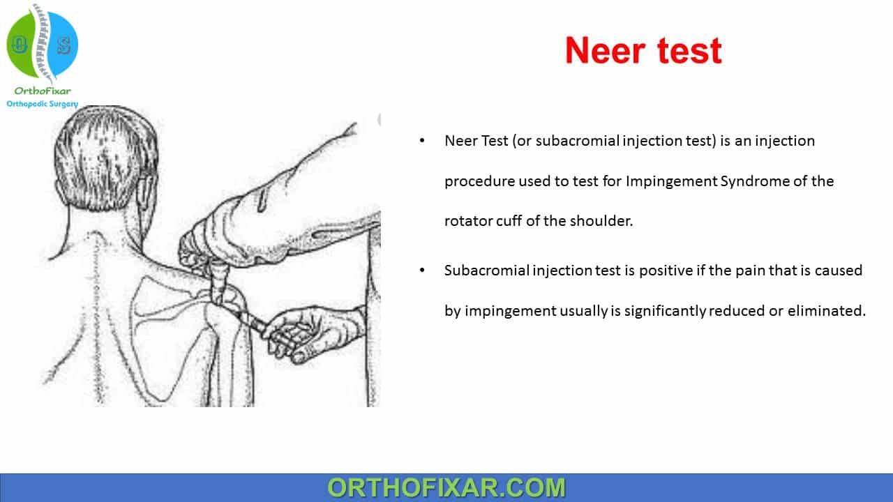  Subacromial Injection Test 