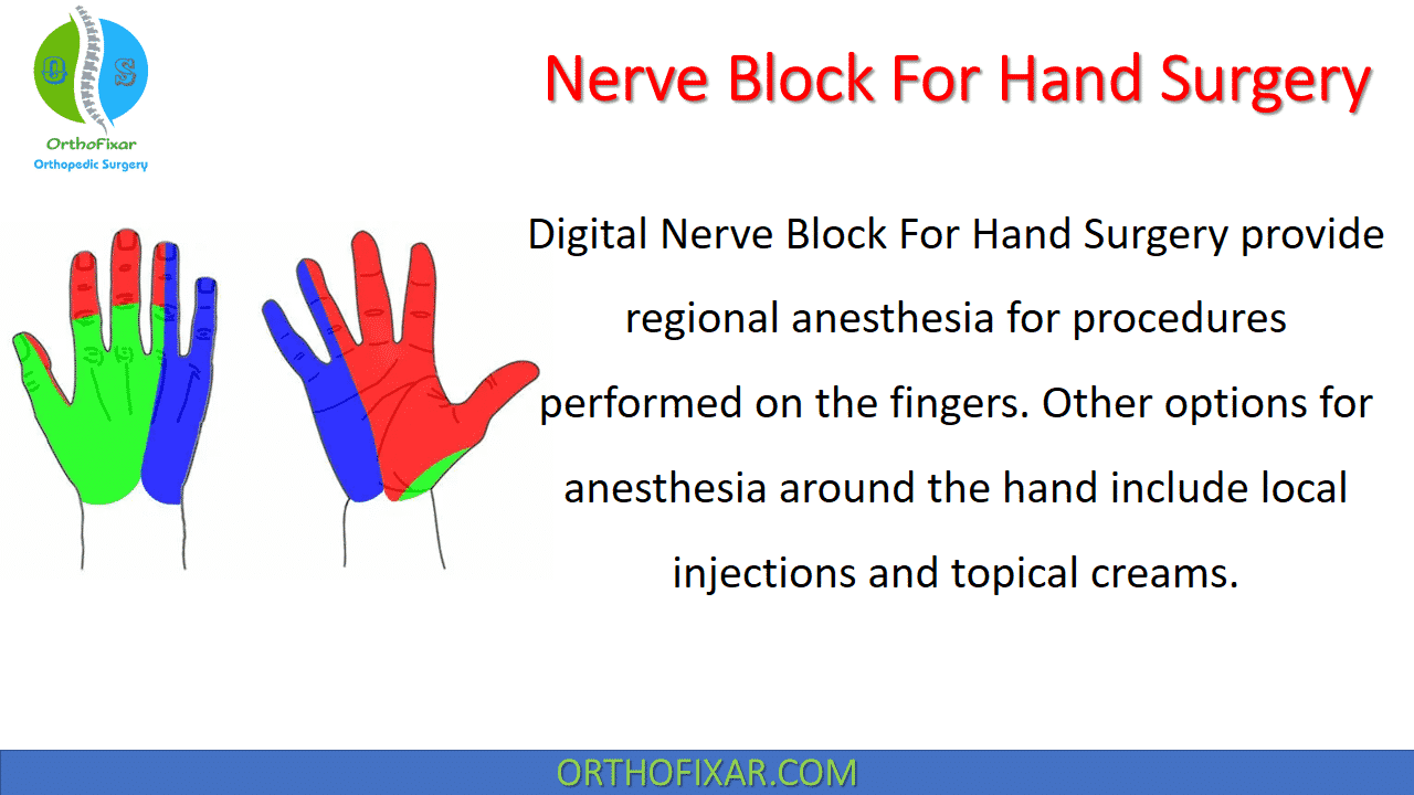  Nerve Block For Hand Surgery 