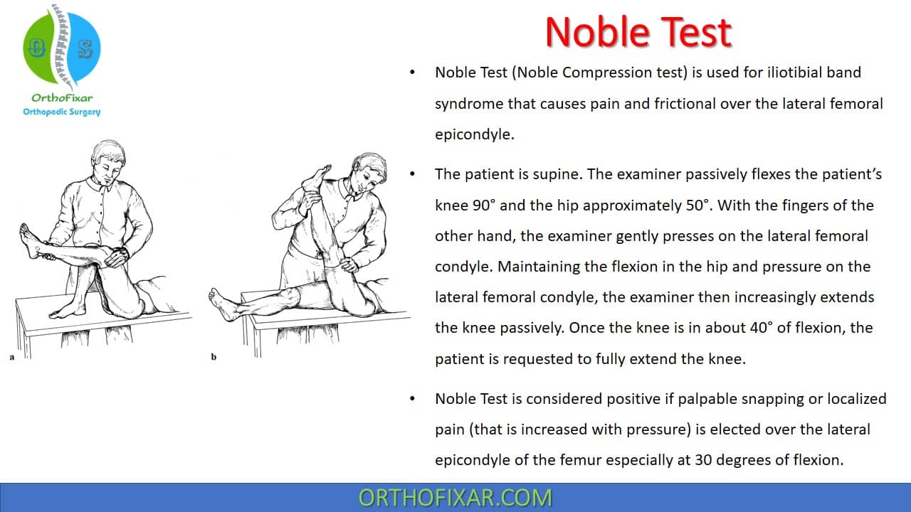 Noble Compression Test