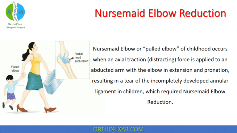 Nursemaid Elbow Reduction Maneuvers