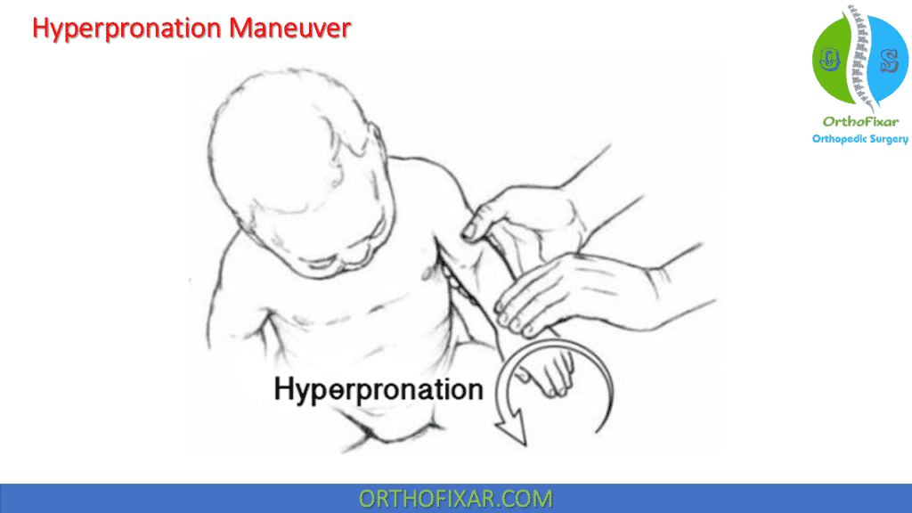 Nursemaid Elbow Reduction with hyperpronation