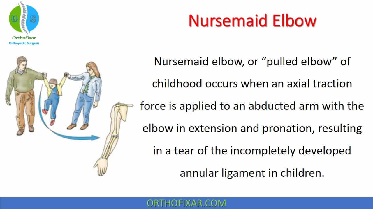  Nursemaid Elbow 