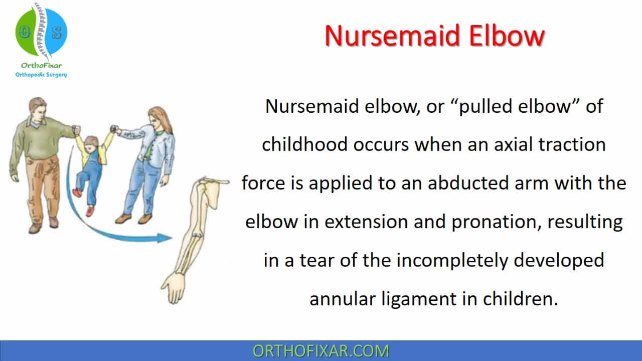 Nursemaid Elbow OrthoFixar