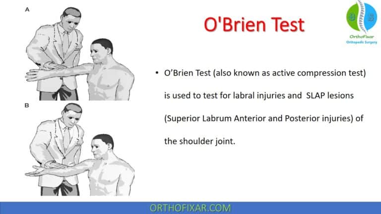 O’Brien Test