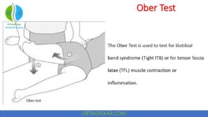 Ober Test Overview | Iliotibial Band Tightness | OrthoFixar 2025