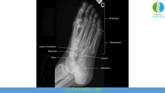 Oblique View of the Foot