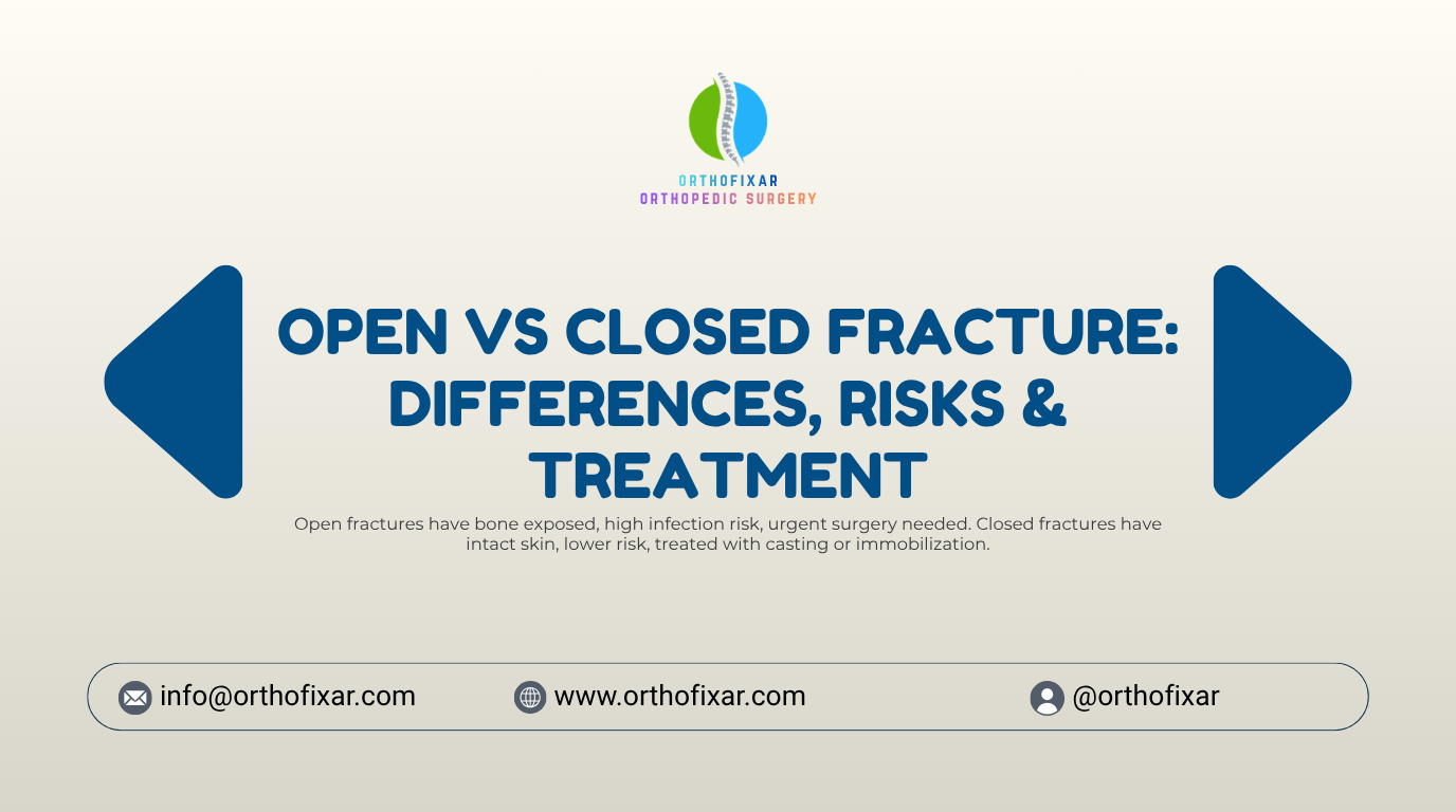 open vs closed fracture