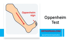 Oppenheim Test