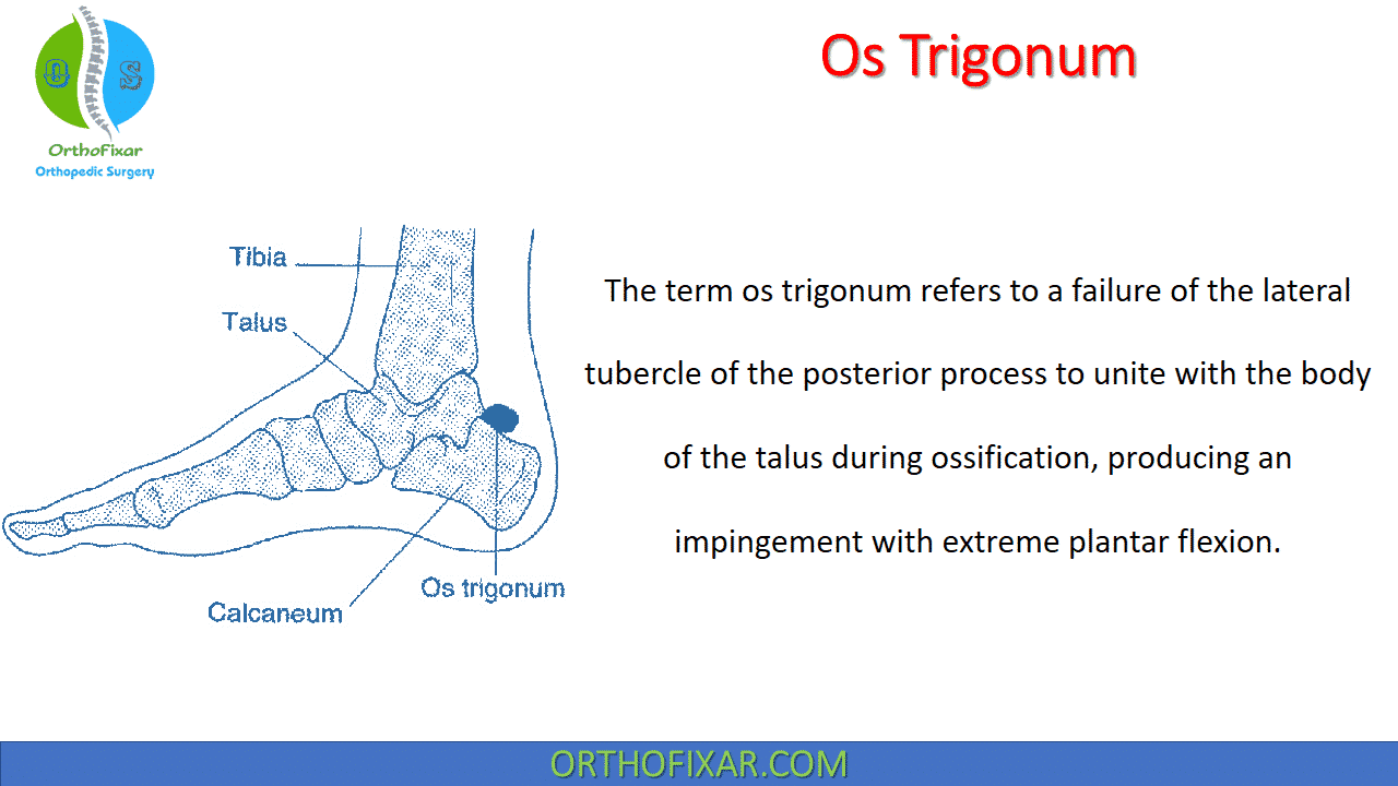  Os Trigonum 